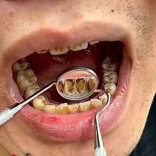 IMAGES X Pasta Gigi Pemutih Gigi Kuning Penghilang Karang Gigi