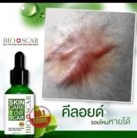 คีลอยด์ รักษาได้  Bioscarไบโอสการ์ ลบแผลเป็น
ตุ่ม รอยสิว แผลเป็น น้ำเหลืองไม่ดี ผิวแพ้ง่ายใช้ได้ !!

ปรับผิวขาว เรียบเนียน ลบรอย 
เข่าดำ ศอกดำ คอดำ ต้องใช้
เซรั่มเข้มข้น เห็นผลไว 

หมายเลขใบอนุญาต/อย. 55-1-6500020182
วันหมดอายุ 15/2/2569