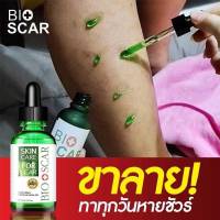 Bioscarไบโอสการ์ ลบแผลเป็น
ตุ่ม รอยสิว แผลเป็น น้ำเหลืองไม่ดี ผิวแพ้ง่ายใช้ได้ !!

ปรับผิวขาว เรียบเนียน ลบรอย 
เข่าดำ ศอกดำ คอดำ ต้องใช้
เซรั่มเข้มข้น เห็นผลไว 

หมายเลขใบอนุญาต/อย. 55-1-6500020182
หมดอายุ 15/2/2569