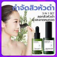 AOPY สูตรอ่อนโยน กำจัดสิวหัวดำ 3 in 1 Set ลบสิวหัวดำและสิว ขจัดผิวที่ตายแล้ว บำรุงกระชับรูขุมขน ผิวกระจ่างใส ครีมลอกสิวเสี้ยน ลอกสิวหัวดำ สิวอุดตัน ลอกได้ทั้งหน้า สูตรใหม่ สำหรับคนเป็นสิว และผิวแพ้ง่าย ( ที่ลอกสิวเสี้ยน ลอกสิวเสี้ยน มาร์คหน้าสิวเสี้ยน)