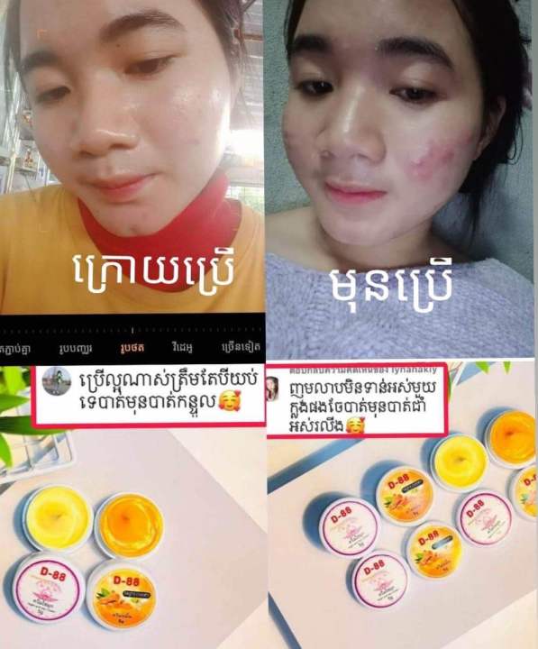 12-ตลับครีมขมิ้นชันครีมทาหน้ากับครีมไข่มุก-แก้สิวฝ้า