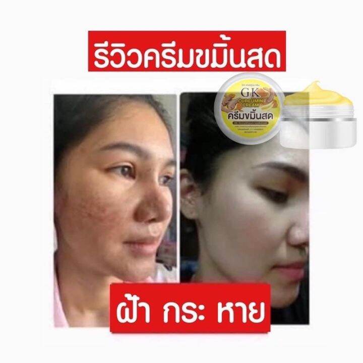 พร้อมส่ง-ครีมขมิ้นสด-gk-10แถม10-ของแท้