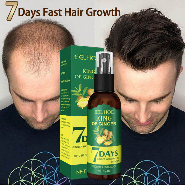 💯 hair growth serum 50ml promotes hair growth For All Types of Hair ...