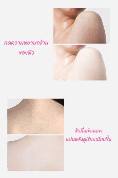 heyxi-สครับขัดผิว