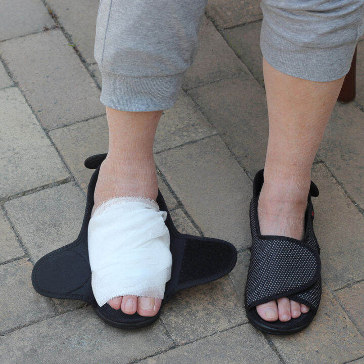 WuChu 2023 Elderly swollen fat diabetic foot gout big foot bone thumb