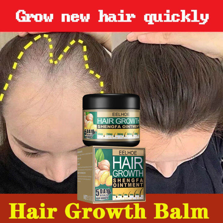 Eelhoe 5 Days Ginger Hair Growth Care Ointment Minoxidil Hair Regrowth