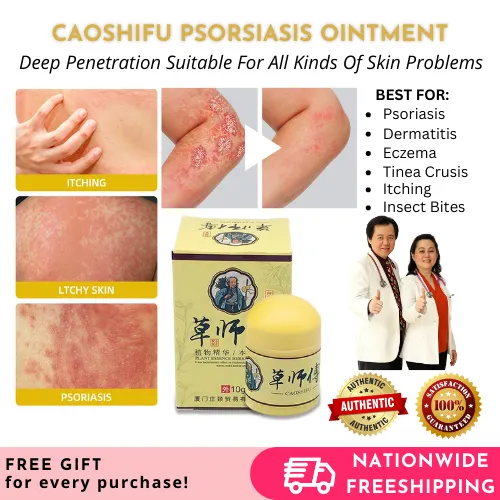 FLASH SALE! 💯 ORIGINAL Caoshifu Ointment Skin Herbal Cream for ...