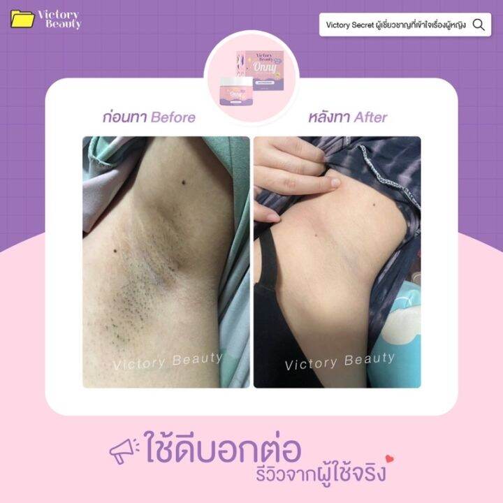 ครีมรักแร้ออนนี่-onny-white-cream-5-กรัม-รักแร้ออนนี่-รักแร้แม่แพท