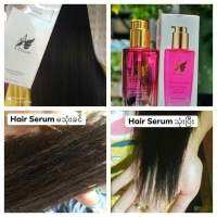 ဆံပင္အသစ္မ်ား ျပန္လည္ထြက္ေစတယ္ Fairy Hsir serum ❣❣

ဒါပဲလား.....Noမဟုတ္ပါဘူး....??

?ဆံပင္ကၽြက္တာ သက္သာမယ္
?ဆံပင္ဖြာတာ သက္သာမယ္
?ဆံပင္ က်ိဳးတာ ျပတ္တာ သက္သာမယ္ 
?ဆံပင္ႏွစ္ခြျဖစ္တာ သက္သာမယ္ 
?ေစးကပ္မွုမရွိပဲ သူအနံေလးက သင္းသင္းေလး

Korea made serum ေလ