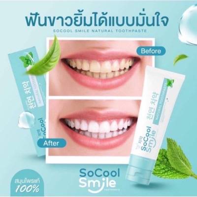 โซคูล สมายด์ ยาสีฟันสมุนไพร SoCool Smile
ขนาด 80 กรัม หลอดสีฟ้า