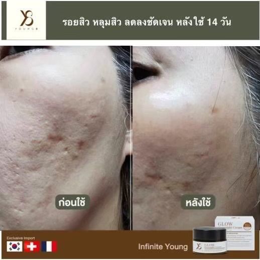 ครีมy8-เซทคู่กู้หน้าใส-ครีมกลางคืน-เซรั่ม