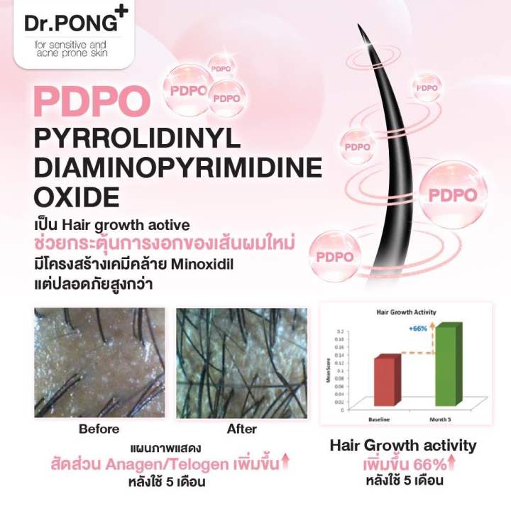 แชมพูลดผมร่วง-dr-pong-tsutsuji-gentle-shampoo-แชมพูลดผมร่วง-เพิ่มวอลุ่ม-anti-hairloss-shampoo