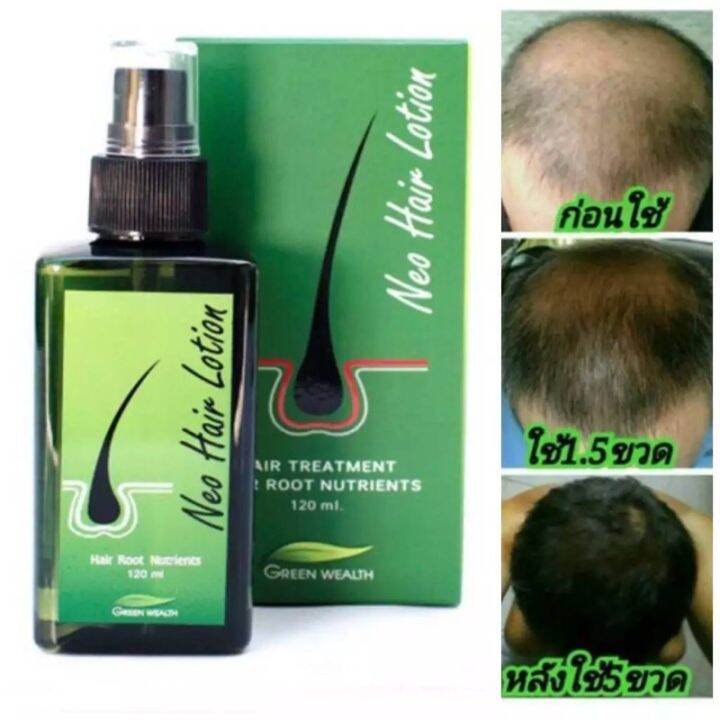 NEO HAIR LOTION HAIR GROWTH SOLUTION ORIGINAL PRODUCT MURAH(READY STOCK