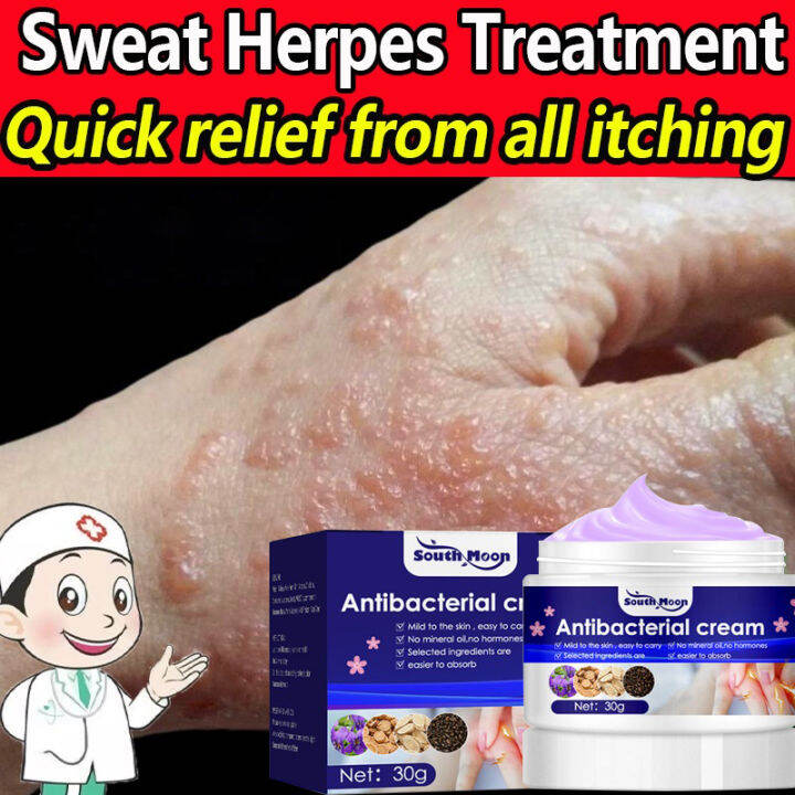【3 Seconds To Relieve Itching 】Sweat Herpes Treatment Blisters Ointment