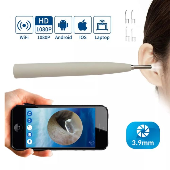 Wireless HD Smart Visual Ear Cleaner Wax Removal Tool Otoscope