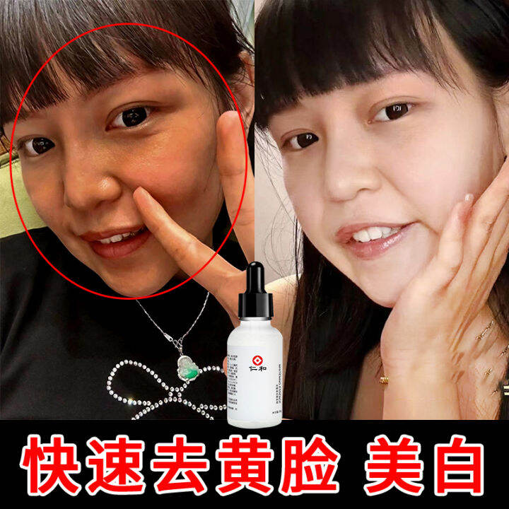 AntiYellowing Gas Whitening Skin Face Dark Yellow Brightening Anti