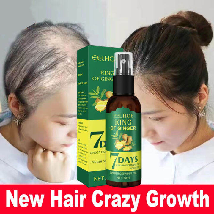 Eelhoe Hair Growth Essence Oil Original Spray Natural Sevich Herbal Serum 7 Day 10 X Faster 3751