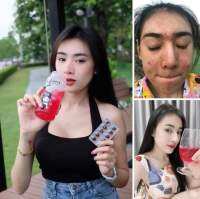 အရင္က ဂ်င္းလို့ ထင္ခဲ့တယ္ ? Saiko Gluta ပြဲတတ္တဲ့ ေန႔က သူတို့ေလးေတြနဲ႔ ေတြ႕ခဲ့တယ္ ?

 အဖြဲ႕တစ္ဖြဲ႕တည္းလည္း ျဖစ္တယ္ ?အျပင္မာျမင္ေတာ့ လုံးဝ wow ျဖစ္သြားတယ္ ?

မ်က္ႏွာေလး ပန္းႏုေရာင္သန္းၿပီး မထိရက္ ၊မကိုင္ရက္စရာေလး?မဗိုက္လည္း ေသာက္ခ်င္လို့