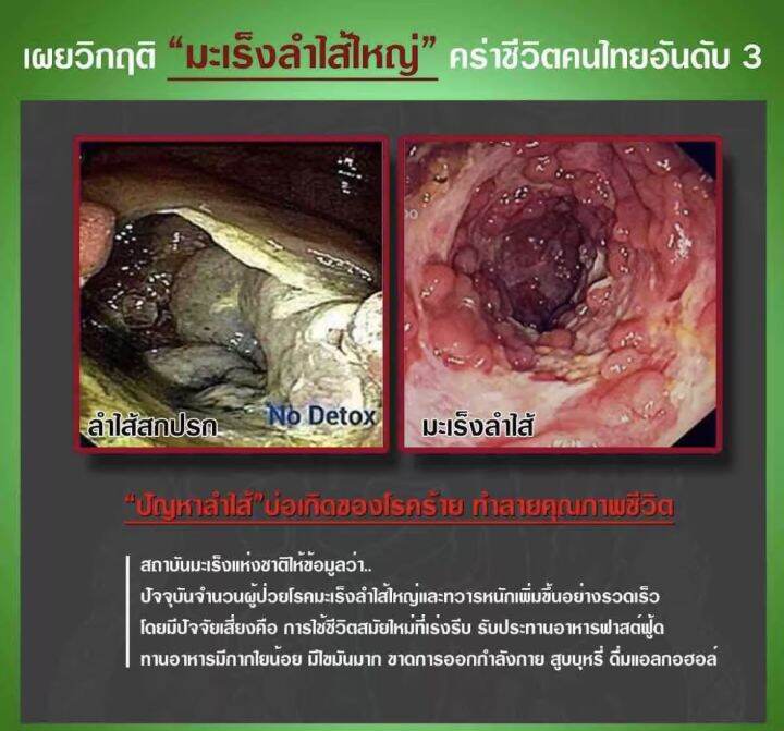 ชุดทดลอง-3-ซอง-ล้างลำไส้-ดีท็อกซ์ลำไส้-ไฟโตไฟเบอร์-ตัวช่วยขับถ่าย-ล้างระบบทางเดินอาหารเห็นผลชัดเจน8-12ชั่วโมง