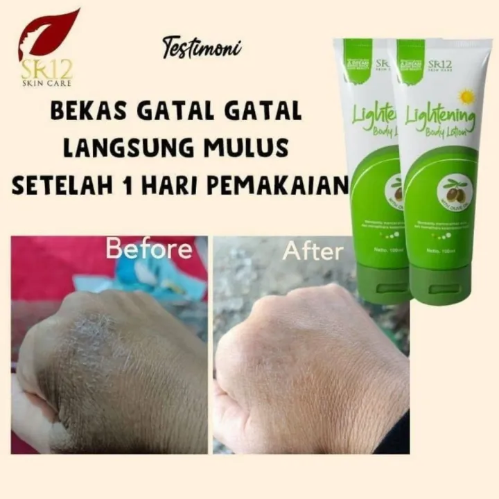 Lightening Body Lotion sr12 Hand Body Untuk Mencerahkan Kulit Hand