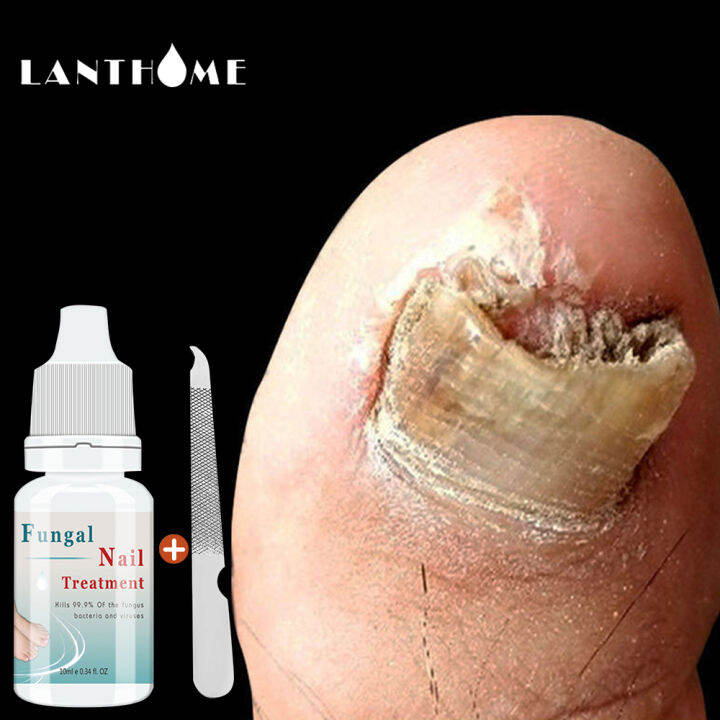 EFERO Nail Repair Essence Serum Fungal Nail Treatment Anti Fungal Nail