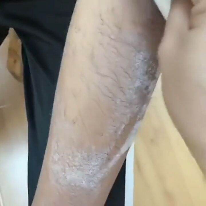 脫毛膏 Hair removal cream Fast Painless hair removal private part hair