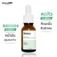 Beleza Skin Acne Serum เซรั่มลดสิว 24 ชม. สิวผดผื่น สิวอักเสบ รอยแดง ผิวอักเสบ ลดหน้ามัน 15 ml

Beleza Skin Acne Serum เซรั่มลดสิว 15 ml

เซรั่มลดสิว ใน 24 ชม. สิวผดผื่น สิวอักเสบ รอยแดง ผิวอักเสบ หน้ามัน รูขุมขนกว้าง 15 ml