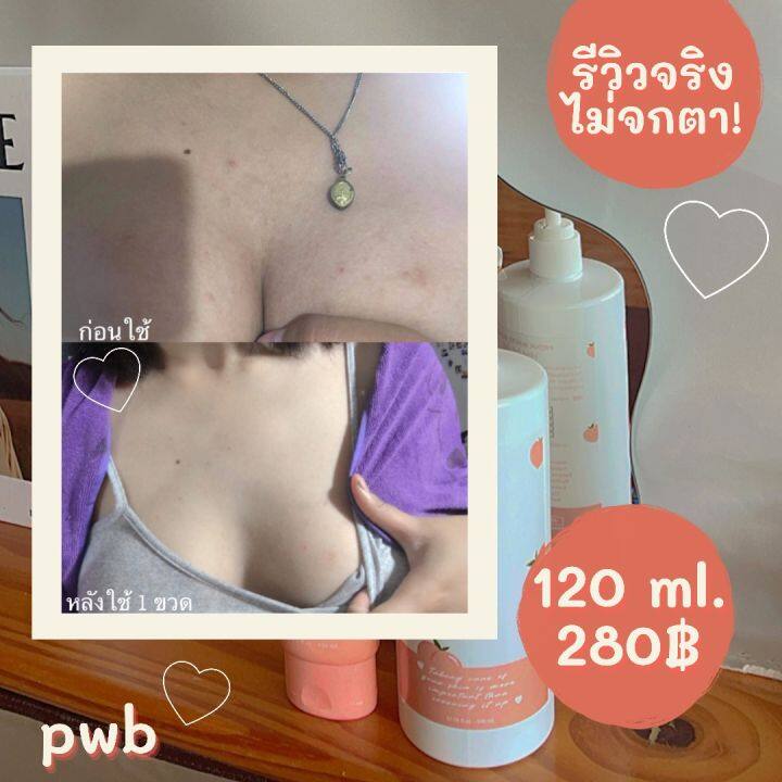 pwb-เลิกก้นดำด้าน-ครีมทาก้น-pwb-ใช้จริง-รีวิวจริง100-ครีมลดรอยจุดด่างดำ-ลดรอยแตก