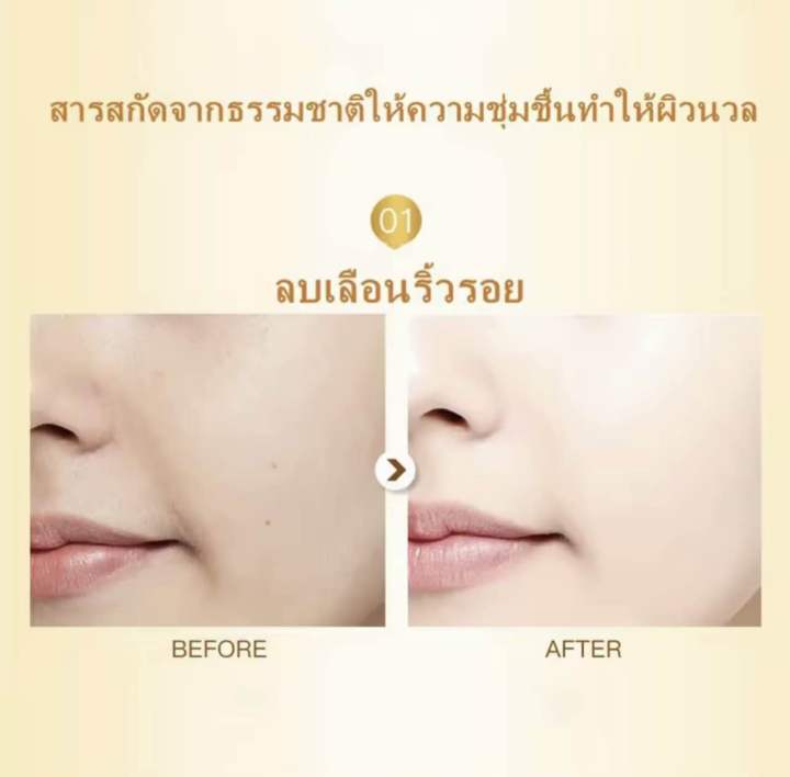 venzen-serum-whitening-drone-serum-เซรั่มผิวขาว-ลดจุดด่างดำ-เอสเซนส์-ทรีทเม้นท์-essence-ครบสูตร-หน้าขาวใส-ลดริ้วรอย-กระชับรูขุมขน