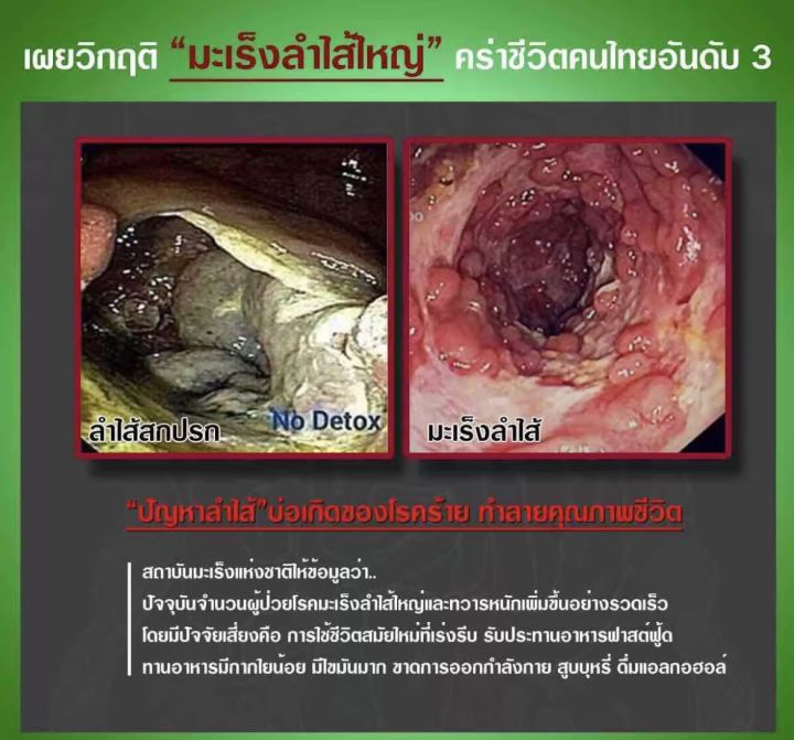 ดีท็อกซ์ลำไส้-ล้างลำไส้-ไฟโตไฟเบอร์คลีนซ์-เซต7วัน7ซอง-ล้างลำไส้ด้วยใยอาหาร-เห็นผลภายใน8-12ชั่วโมง