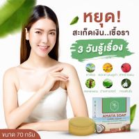 สบู่อมตะมอร์ดรีม สะเก็ดเงิน เชื้อรา กลากเกลื้อน หายได้ ขนาด 70 กรัม พร้อมส่ง