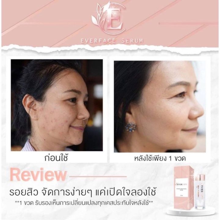 ของแท้-ของแท้-everface-serum-เอเวอร์เฟสเซรั่ม