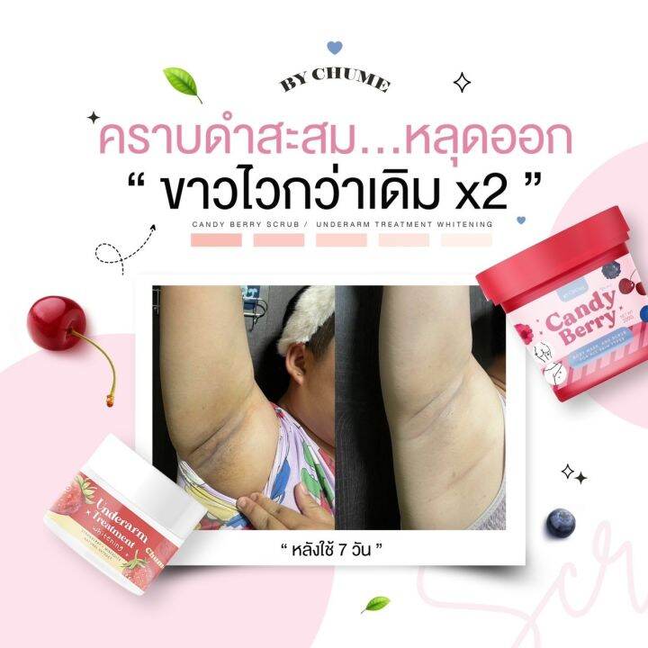 สครับผิวกลิ่นหอมเบอร์รี่-chume-candy-berry-scrub-ลดรอยดำคล้ำ-ผิวเนียน-ลดขนคุด-เนื้อนุ่มเนียนละเอียดไม่บาดผิว