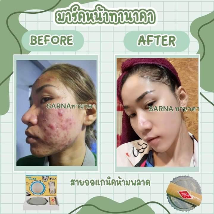 ส่งฟรี-แถมฟรีแปรงมาร์ก-ทานาคา-ทานาคาพร้อมหินฝน-ทานาคาแท้นำเข้าจากพม่า