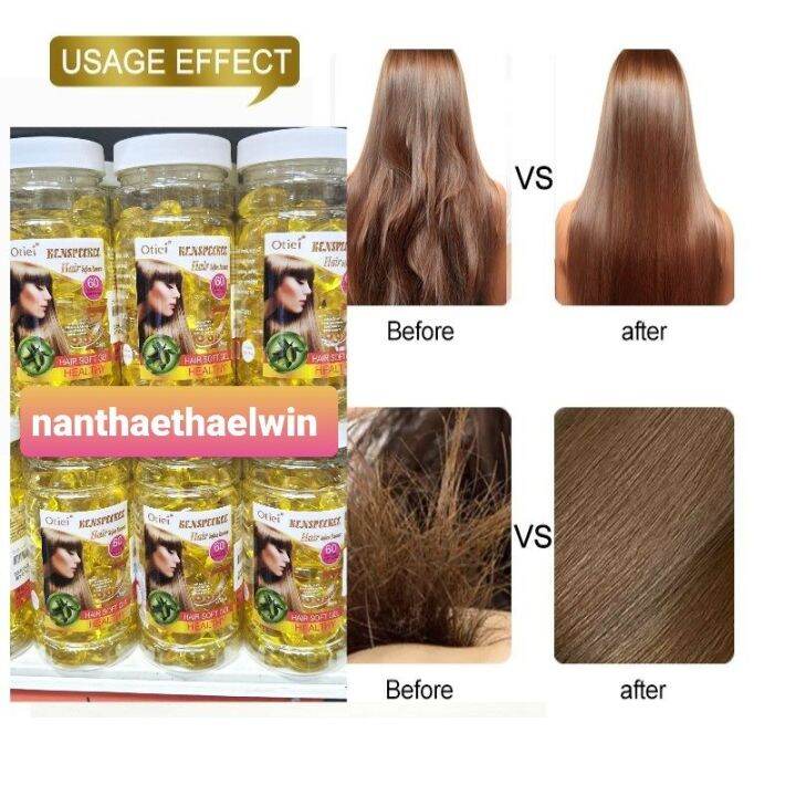 VITAMIN E FOR HAIR Lazada