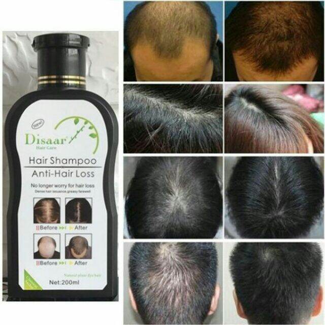 DISAAR HAIR SHAMPOO ANTI HAIR LOSS | Lazada