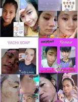 Vachi လိမ္တယ္ ​??

ေျပာေတာ့၀က္ၿခံေတေပ်ာက္မယ္တဲ့ 

အခု၀က္ၿခံေတေပ်ာက္တဲ့အျပင္ 

အဆီျပန္တာေတ အမဲစက္ေတ တင္းတိပ္ေတ အဆီဘု ေတ

 အားလုံးေျပာက္ကုန္တယ္ ?မ်က္ႏွာေလးတင္းရင္းၿပီး Glow ေနေရာ ဘဲ ?

လိမ္တယ္ Vachi
#Vachithailand 
#ထိုင္းနိုင္ငံေနရာအႏွံံ့ပိုေပးပါတယ္