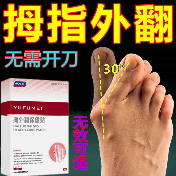 Thumb Valgus Plaster Big Foot Bone Corrector Big Mother Toe Toe Foot