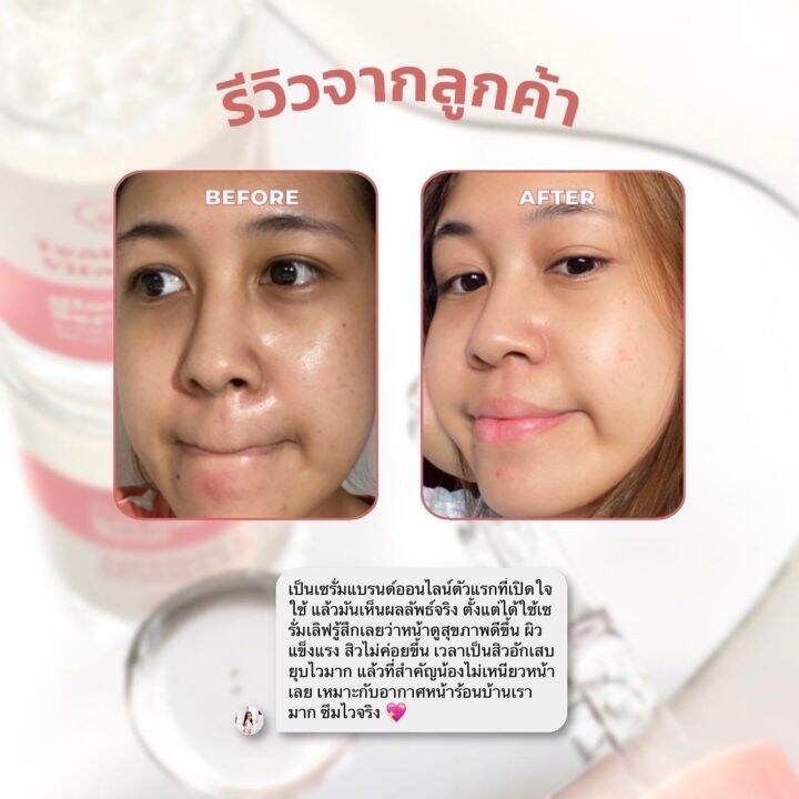 เซรั่มเลิฟสูตรพรีเมี่ยม-30ml-เซรั่มเลิฟบิ๊ก-ลดสิวผิวแข็งแรง