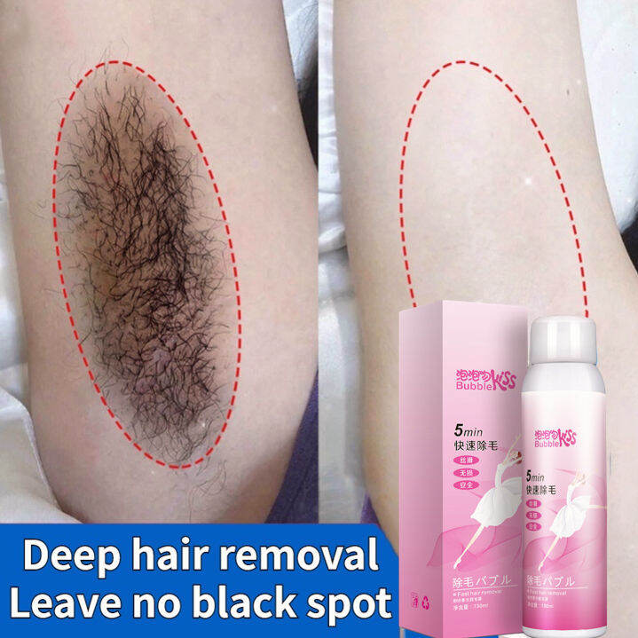 Hair removal cream Private Part Hair removal 5min Hair removal spray