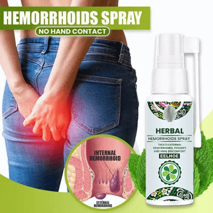 Fast Hemorrhoids Remover Natural Herbal treatment Hemmorhoids Spray ...