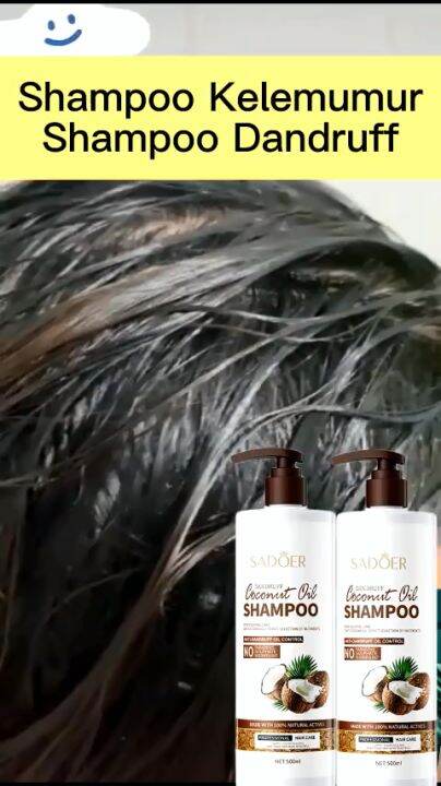 Sadoer Coconut Shampoo Anti Dandruff Syampoo Kelemumur Ubat Kepala