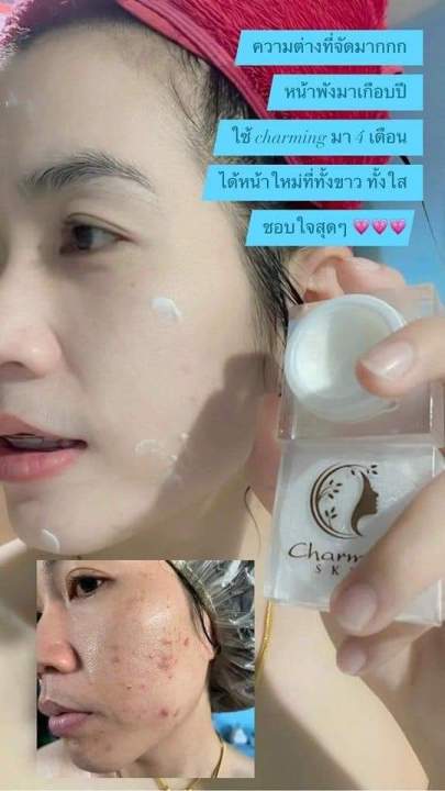 เซตใหญ่ๆไซร์จำโป้-ใช้แล้วคุ้มมากๆจ้าไนท์ครีม20กรัม-เซรั่มขนาด30ml-สบู่ส้ม60กัม-กันแดด15กรัม-โปรแบบนี้ถูกสุดๆจ้า-ส่งฟรี-ไม่มีบวกเพิ่ม