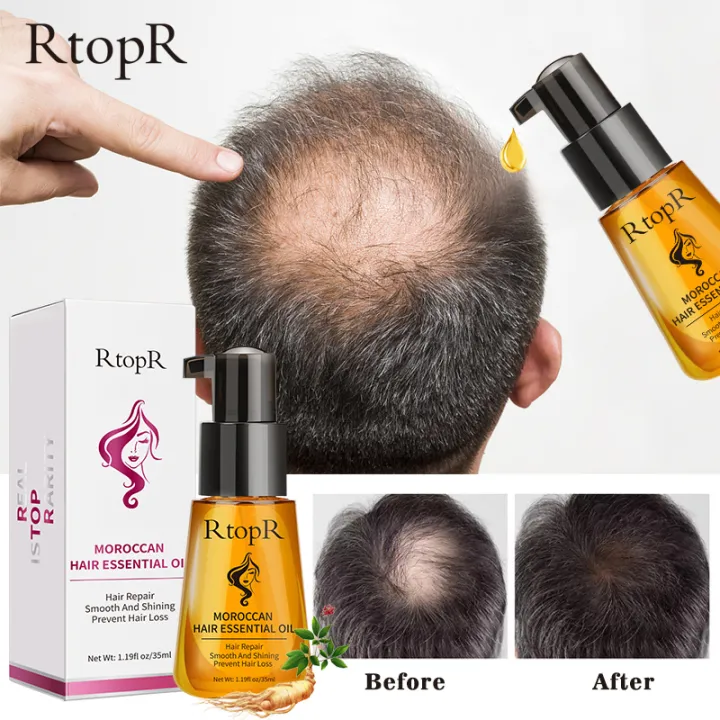 RtopR Moroccan Prevent Hair Loss Product Hair Growth Essential Oil Easy To  Carry Hair Care Nursing 35ml Both male and female can use | Lazada PH