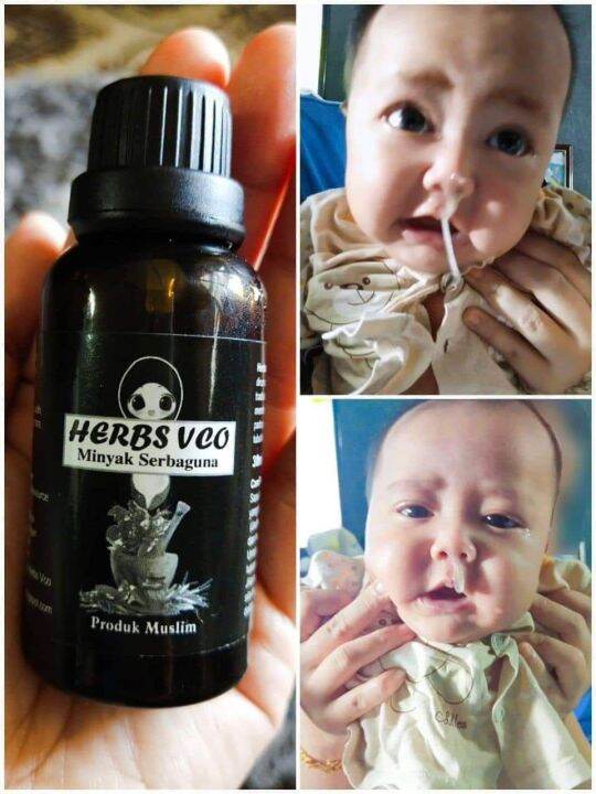 MINYAK VCO HERBS Lazada