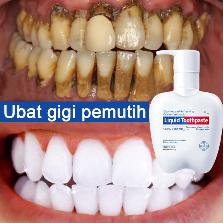 Ubat gigi pemutih Whitening Toothpaste 200g pemutih gigi teeth ...