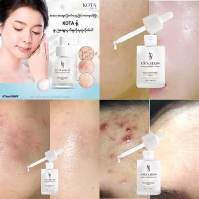 KOTA SERUM Hydro Luminous Essence