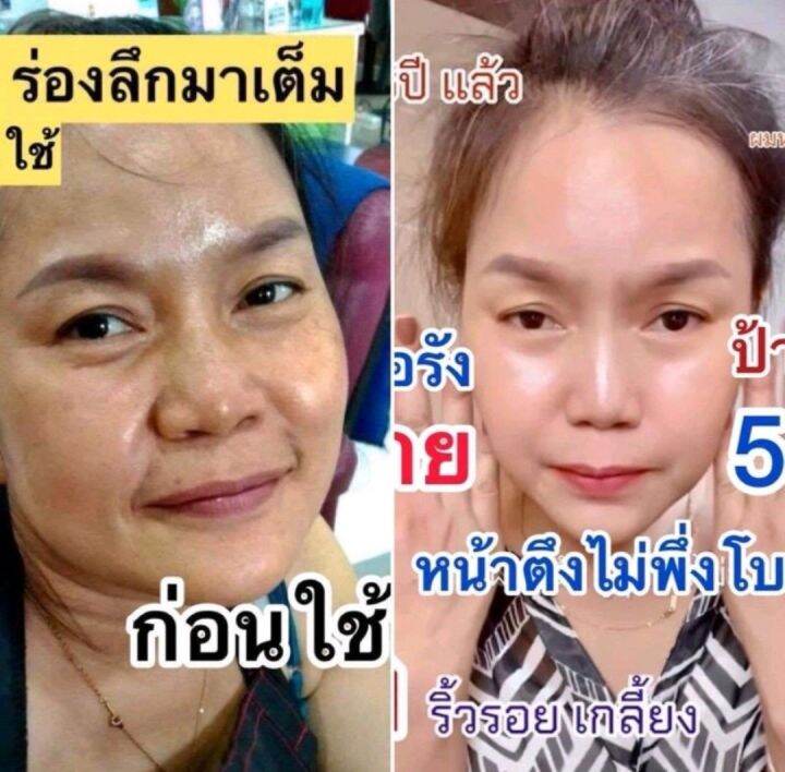 mayaเซรั่ม-mayaโบท็อกซ์-เซรั่มมายา-เซรั่มโบท็อกซ์มายา-เซรั่มโบท็อกซ์maya-เซรั่มโบท็อกซ์-mayaโบท็อก