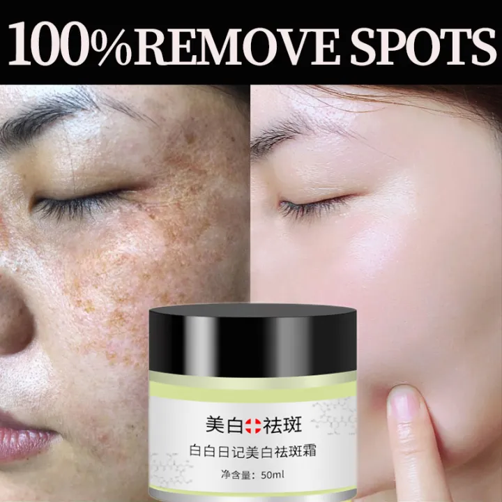 Whitening Freckles Cream Remove Melasma Dark Spot Lightening Melanin Brightening Melasma Remover