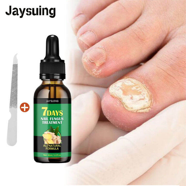 lanthome Nail Repair Essence Serum Fungal Nail Treatment Anti Fungal Nail Solution Hand Foot